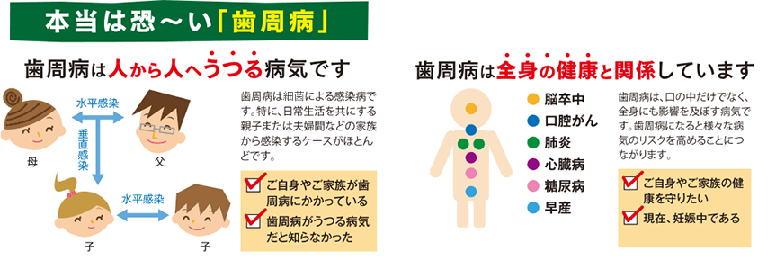 画像に alt 属性が指定されていません。ファイル名: periodontosis_ph01.png